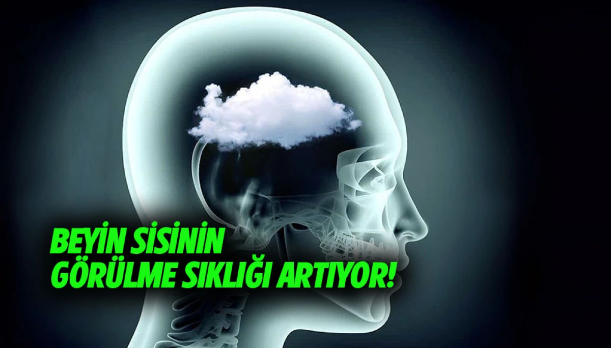 Beyin sisinin g&ouml;r&uuml;lme sıklığı artıyor!