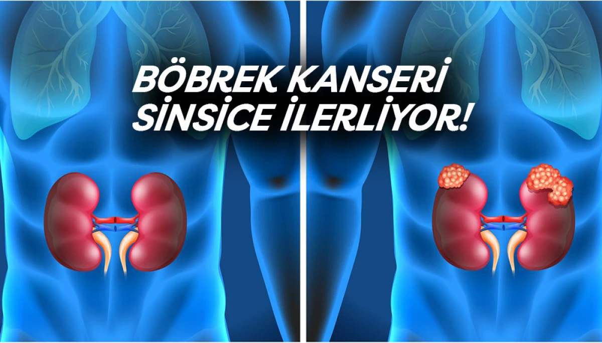 B&ouml;brek Kanseri Sinsice İlerliyor! 