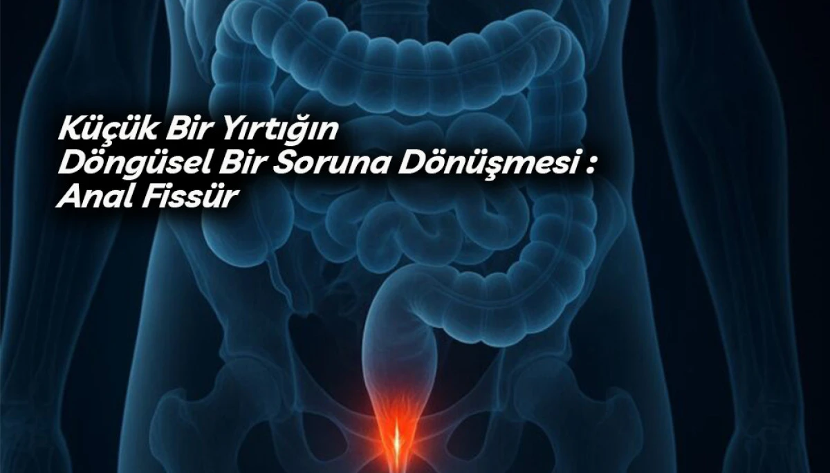 K&uuml;&ccedil;&uuml;k Bir Yırtığın D&ouml;ng&uuml;sel Bir Soruna D&ouml;n&uuml;şmesi Anal Fiss&uuml;r